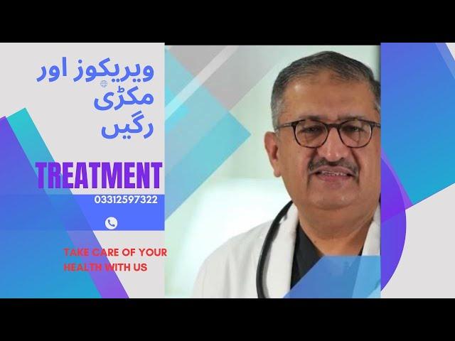 Treatment of Varicose Veins & Spider Veins by Dr Imtiaz Ahmad is possible without Surgery