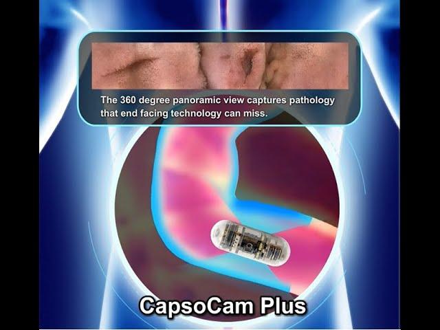 CapsoCam Plus VS End-view Capsule