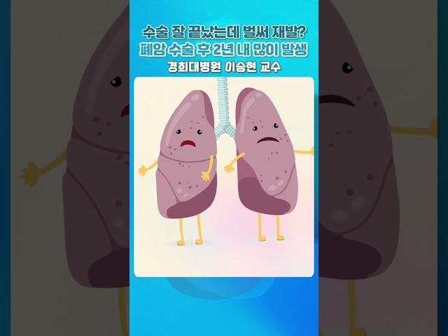 수술 잘 끝났는데 벌써 재발? 폐암 수술 후 2년 내 많이 발생