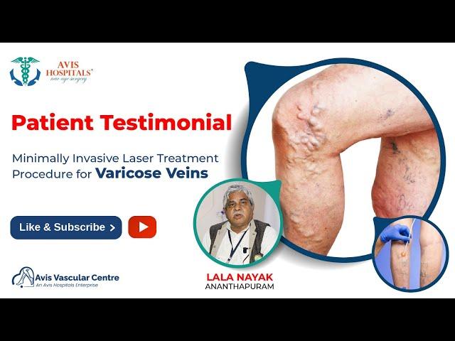 Minimally Invasive Laser Treatment Procedure for Varicose Veins | Avis Hospitals