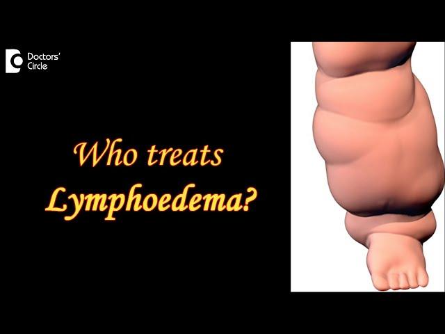 Who treats LYMPHOEDEMA? | Plastic Surgery | Microvascular Surgery - Dr. Srikanth V | Doctors' Circle