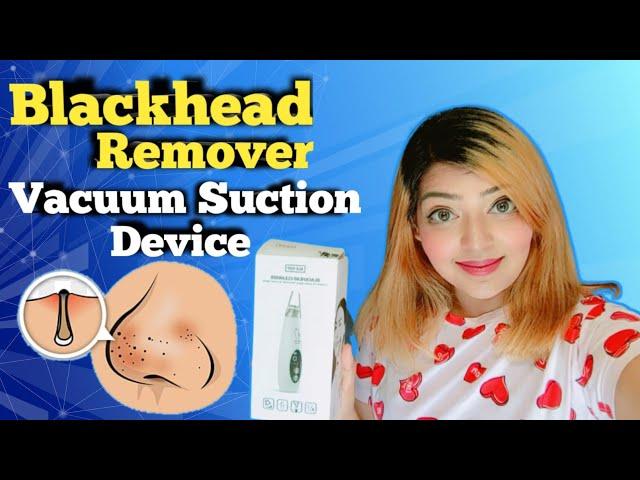 How To Use Blackhead Vacuum Suction Machine || blackhead pore vacuum | Does it Work???