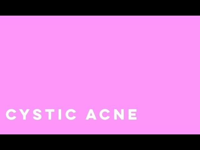 Photodynamic Therapy for Cystic Acne l Total Dermatology