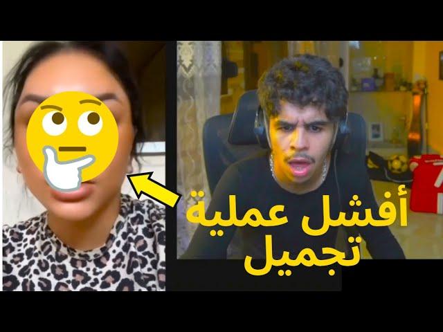 ريبيكا بعد عملية التجميل 
