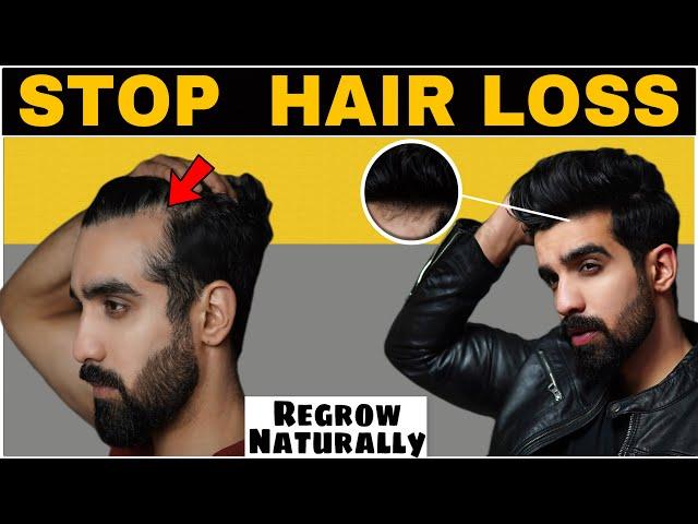 7 Ways to STOP HAIR FALL *NATURALLY* REGROW Hair| Hair fall| Hair thinning| Receding hairline