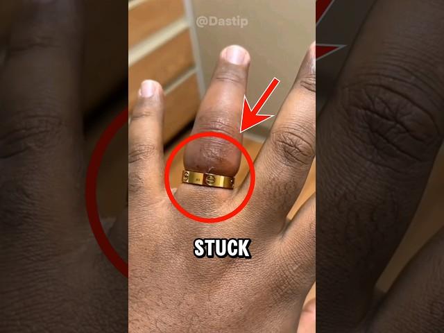 how to remove a ring stuck on finger