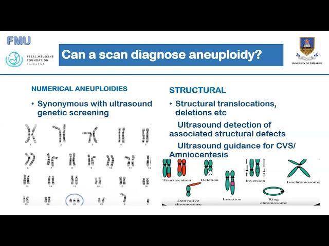 Aneuploidy Screening Dr C Chirume