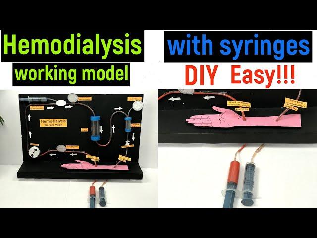 hemodialysis working model - hemodialysis working model with syringes - diyas funplay - diy project