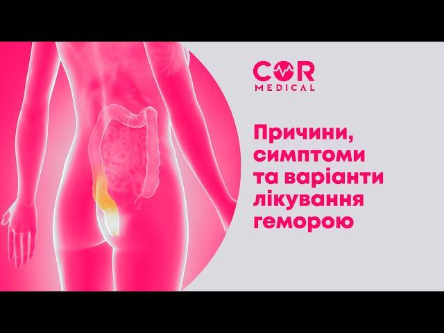 Запитання проктологу. Частина перша: причини, симптоми та варіанти лікування геморою