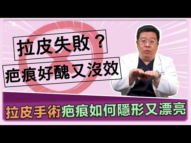 中下臉拉皮失敗疤痕可怕又沒效?! 全層次筋膜拉皮手術原理及疤痕隱形漂亮的原因解析! ｜林敬鈞醫師｜巨星整形外科