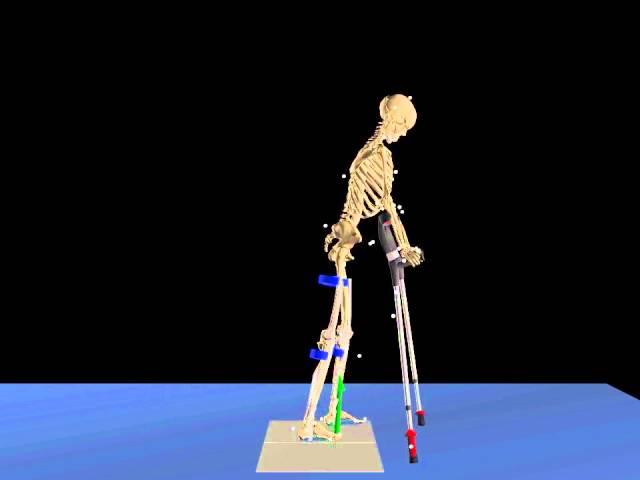 Gait simulation of a SCI subject