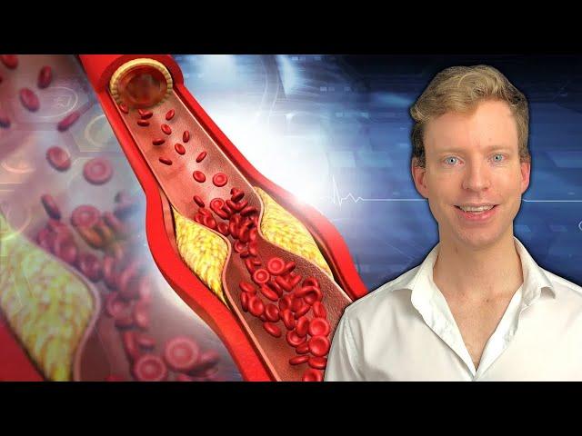 How To CORRECTLY Lower Cholesterol & Why