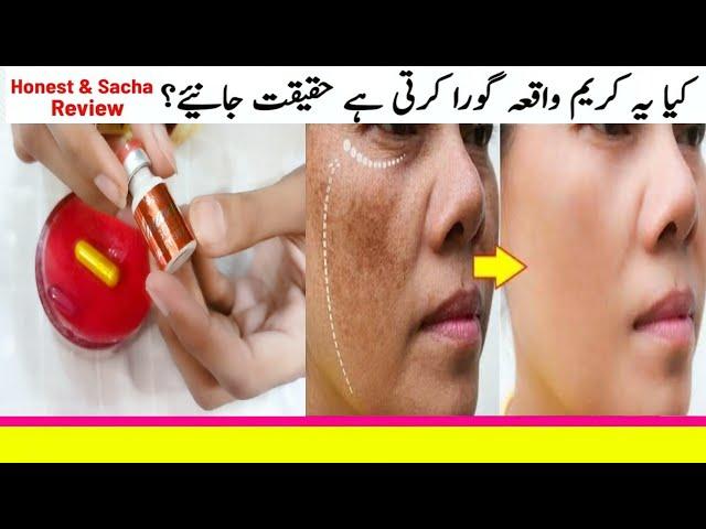 Best instant whitening cream formula without side effects - Amazing gold Beauty cream for wrinkles