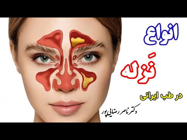 آشنایی با انواع نزله در طب ایرانی با دکتر ناصر رضایی پور