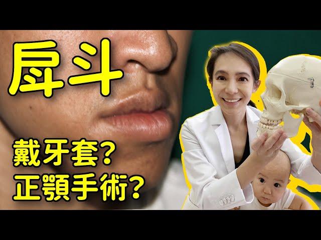 戽斗戴牙套矯正能改善臉型？還是一定要正顎手術？｜林榆芩醫師