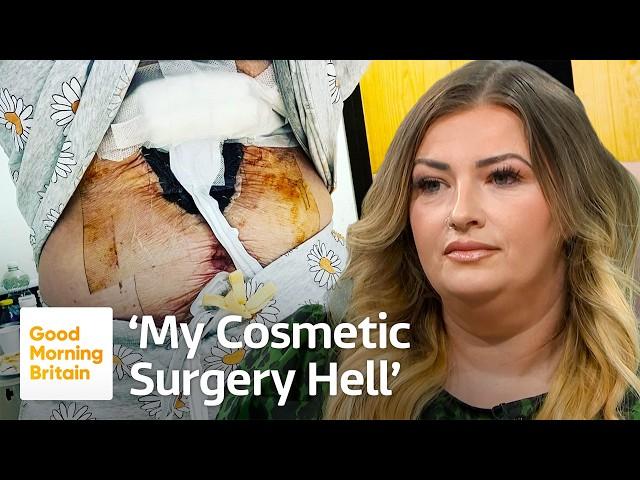 I Nearly Died After Cosmetic Surgery in Turkey