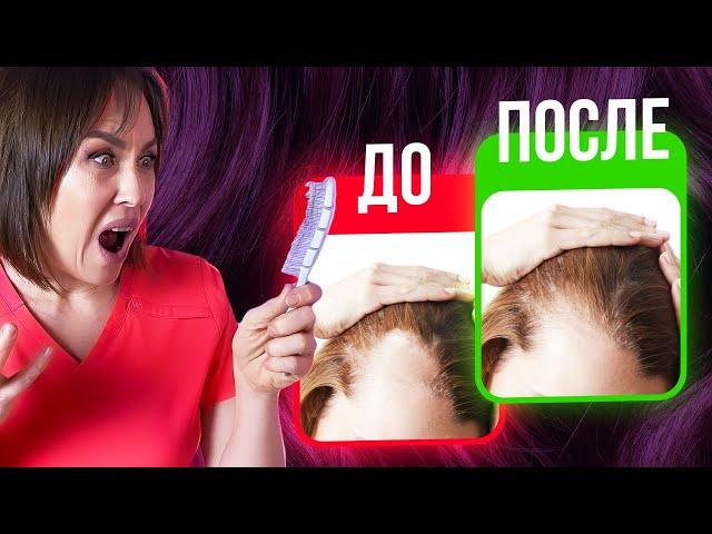 Выпадают волосы? ‍️ Как сделать волосы гуще?