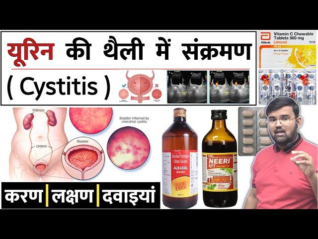 Cystitis | यूरिन की थैली में संक्रमण | Medicine | Treatment | Pharmacy | Doctor | Nursing | MBBS