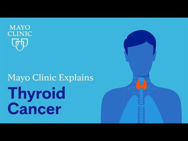 Mayo Clinic explains thyroid cancer