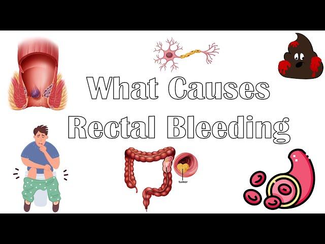 What Causes Per Rectal Bleeding |Major Causes Of Blood In Stools |Rectal Bleeding Causes