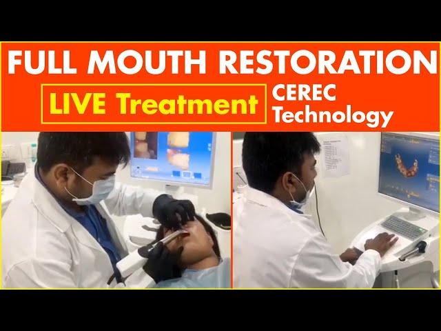 Full Mouth Restoration - LIVE Treatment | CEREC Technology | Dental Care | Eledent Dental Hospitals