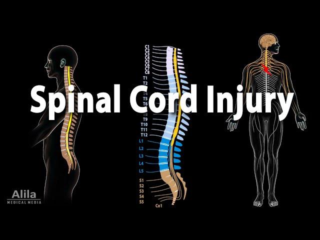 Spinal Cord Injury, Animation