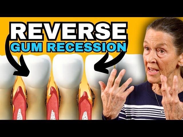 New & Easy way to REGROW Receding Gums at Home in 2024