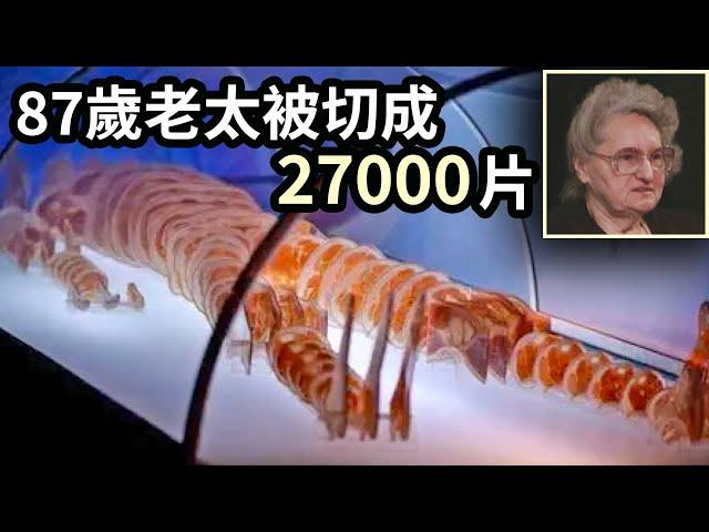 87歲老太死後被切成27000片，被萬人圍觀！每一片肉體都經過打磨拋光，成為史上最慘人類遺體 | 數字人 | 可視人 | 解剖