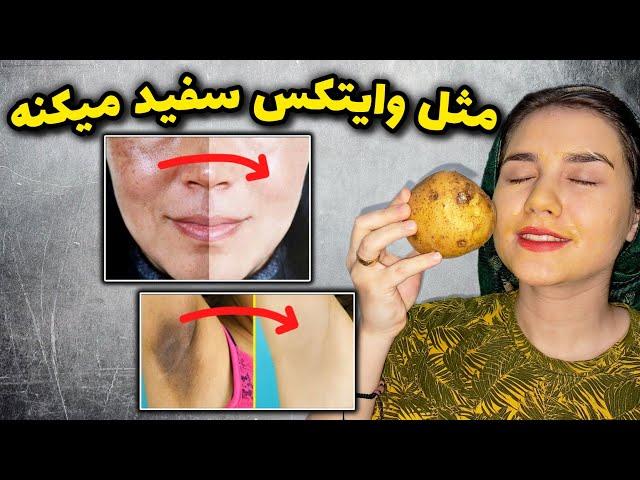 بی شک از بهترین ماسک های روشن کننده و ضد لک هست. (فقط ی بار امتحان کن پشیمون نمیشی)