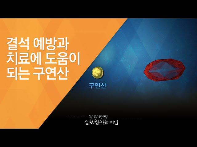 결석 예방과 치료에 도움이 되는 구연산 - (2015.9.30_555회 방송)_내 몸 속의 위험한 돌, 결석