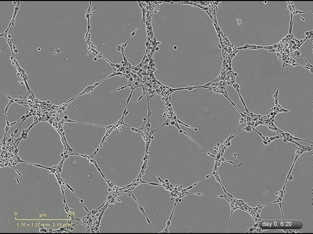 Formation of lumens by endothelial cells in vitro