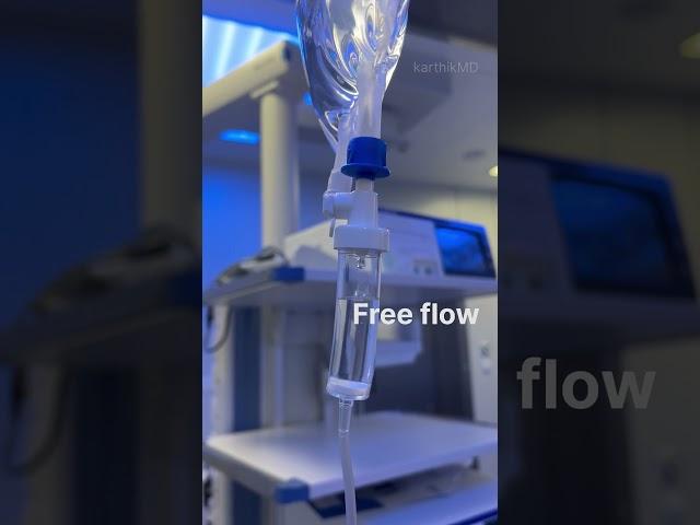 IV cannulation | EJV Cannulation
