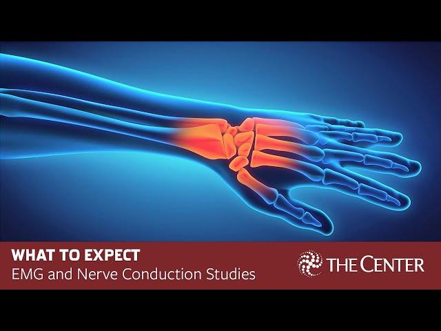 What to Expect During Nerve Conduction Studies and EMG Tests