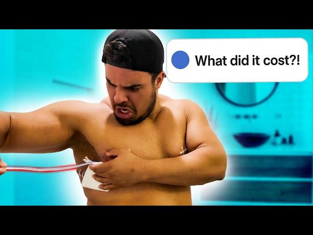 I had Gyno Surgery | Cost Breakdown | Surgery Drains Removal