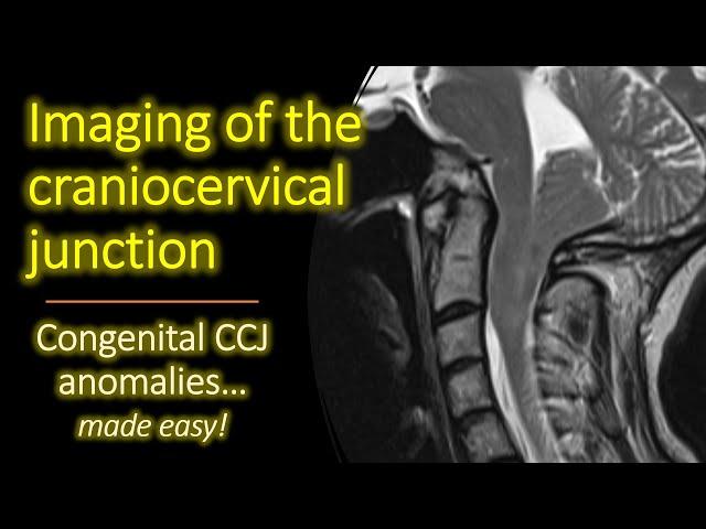 Imaging of Congenital Craniocervical Junction Anomalies.