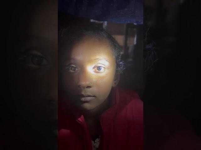 AIOCMT3 2024 - VT1 - Dr.Chanana Priyanka - Unilateral Light near dissociation- Afferent pupillary...