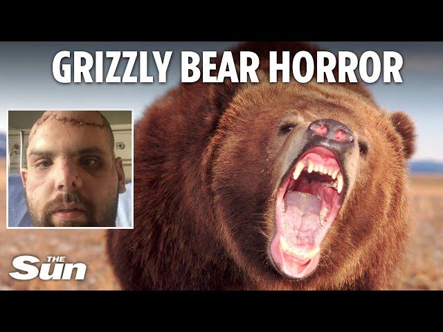 My face was torn off by a grizzly bear – I was left holding pieces of my ear & scalp