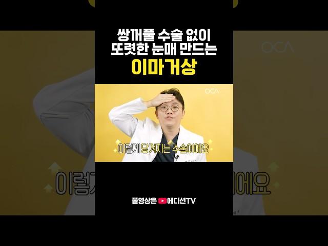 쌍수 이마거상 고민 중인 분들 보세요! 처진 눈꺼풀, 졸린 눈 솔루션 #자연스러운 #눈매 #이마거상