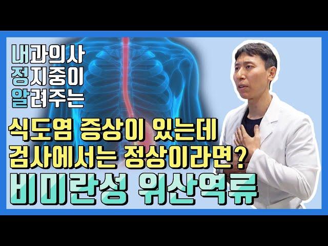 위도 운동부족 현상을 겪는다?  비미란성 위산역류!