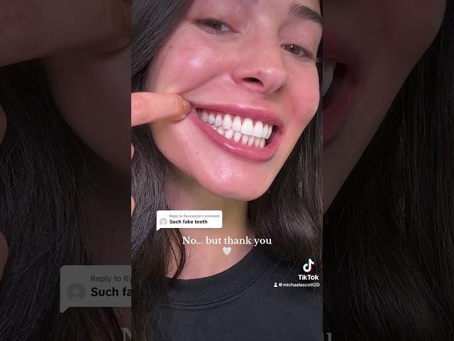 No bonding, no veneers or crowns. But I appreciate the compliment!