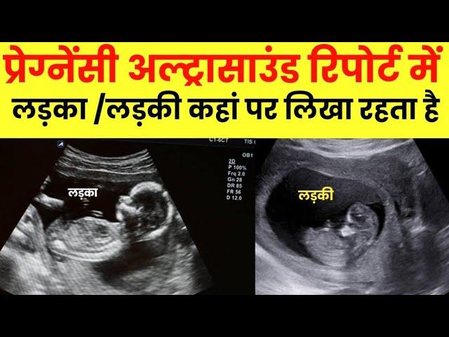 Pregnancy ultrasound se kaise pata krein ki ladka hai ya ladki