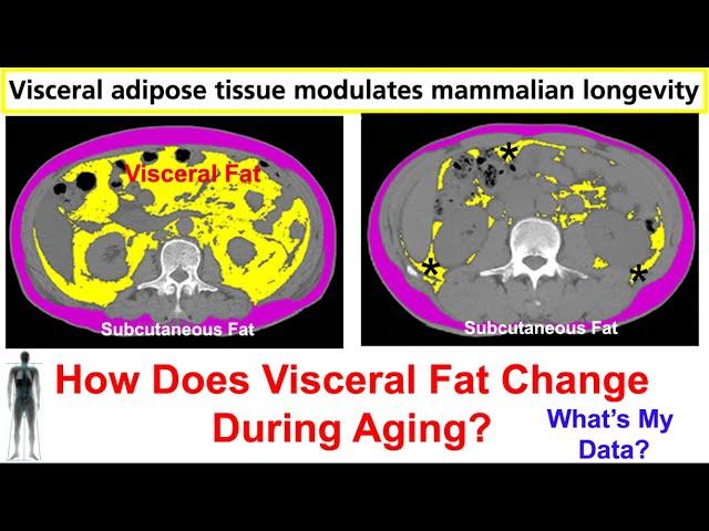 Visceral Fat Removal Extends Lifespan