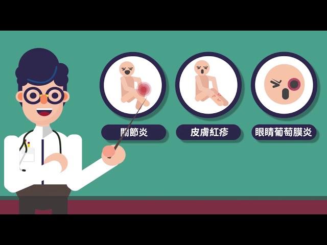 【發炎性腸道疾病】腸腸出狀況-好友默契大考驗