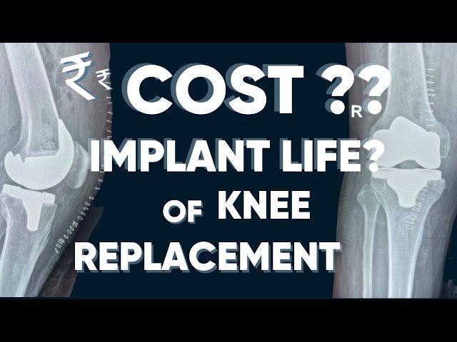 Cost of Knee Replacement in India ? || Lifespan of knee replacement Implant in Life Years