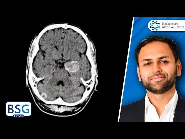 Brain Metastases Management | Neurosurgery Course | March 21, 2023