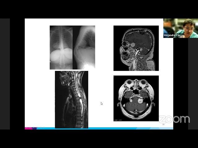 Mount Sinai Neurosurgery TeleRounds