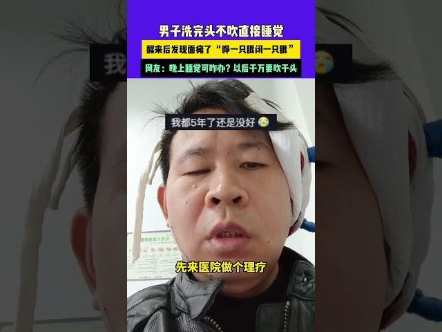 11月23日（發布） 陜西 男子洗完頭不吹直接睡覺，醒來后發現面癱了 “睜一只眼閉一只眼”，網友：晚上睡覺可咋辦？以后千萬要吹干頭#面癱 #萬萬沒想到