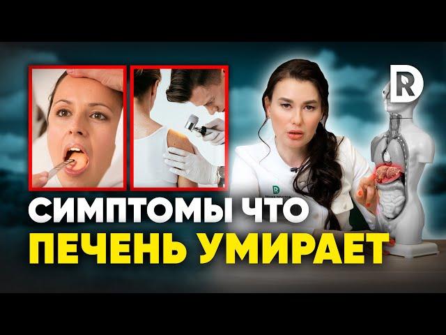 5 симптомов ЗАБОЛЕВАНИЯ ПЕЧЕНИ. Чем ОПАСНЫ проблемы с ПЕЧЕНЬЮ