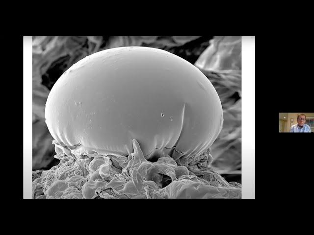 Exploring the fascinating development of cannabinoid-producing trichomes -  Zamir Punja, PhD