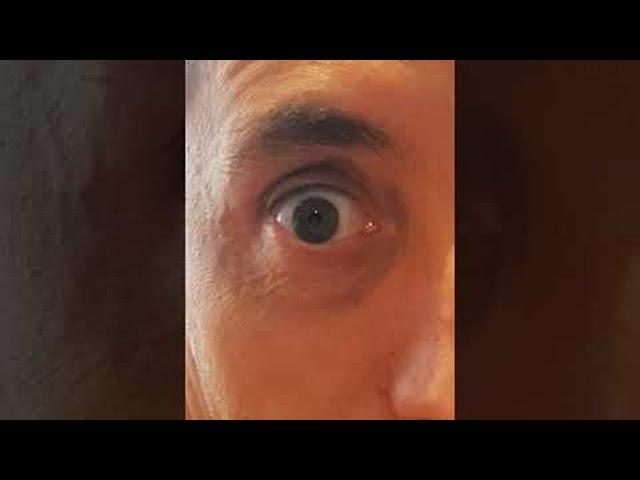 Man Dilates Pupils on Demand || ViralHog